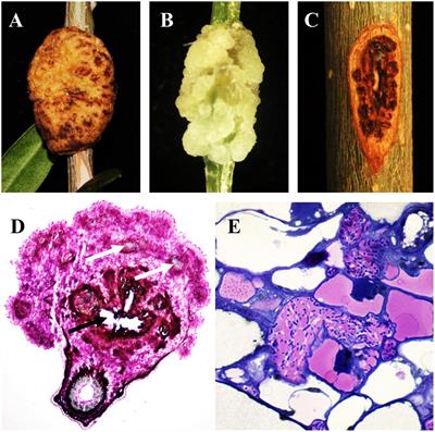 Knots Untie: Molecular Determinants Involved in Knot Formation Induced by Pseudomonas savastanoi in Woody Hosts